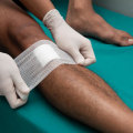 The Importance of Modern Dressings in Wound Care