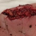 The Importance of Properly Covering Wounds for Optimal Healing