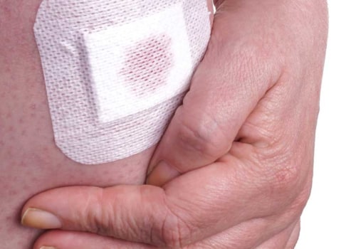 Yellow Wound Healing Slough Tissue Care Made Simple With Gauze Dressing Solutions