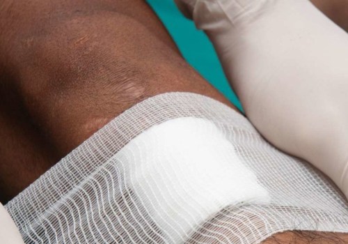 The Best Dressings for Open Wounds: An Expert's Perspective