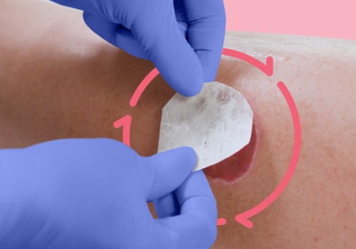 How To Manage Collagen Wound Dressing Side Effects With Gauze Dressings