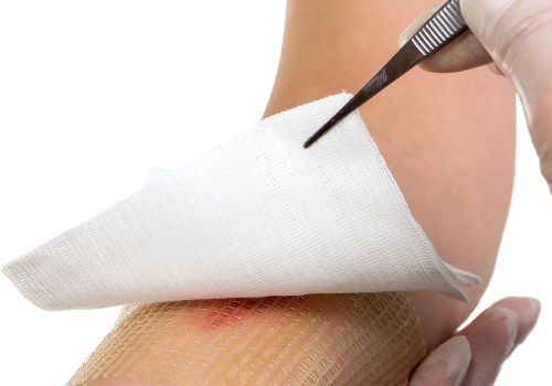 Effective Management of Slow Healing Wounds With Gauze Dressings