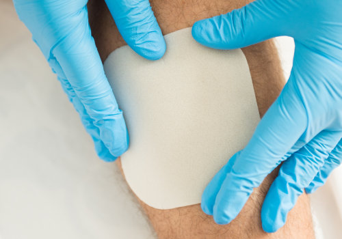 The 5 Essential Rules of Wound Dressing